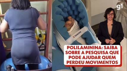 Nova pesquisa pode ajudar quem perdeu movimentos